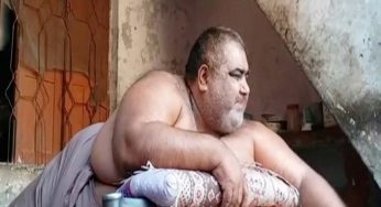 Overly obese patient, Noor Hassan passes away in Lahore