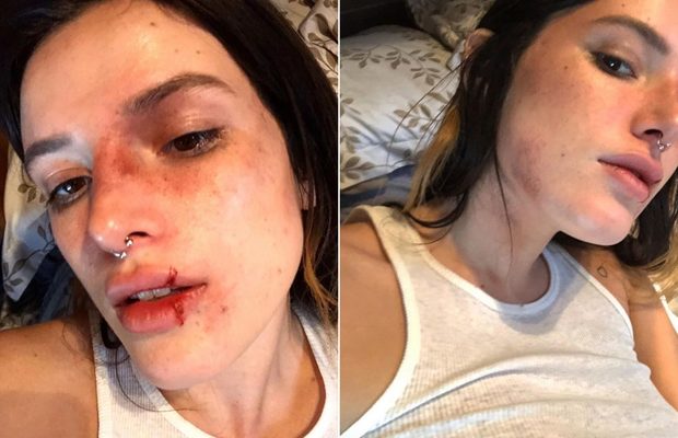 Bella Thorne Faces Backlash for Bruised Makeup Look on Halloween 