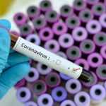 Coronavirus: NIH begins examining samples for diagnoses