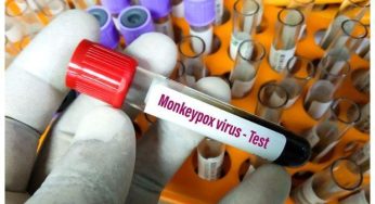 Pakistan reports first confirmed case of Monkeypox