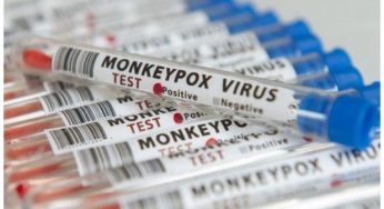 Sindh Health Department denies reports of suspected Monkeypox cases in Karachi