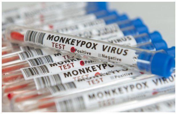 Sindh Health Department denies reports of suspected Monkeypox cases in Karachi