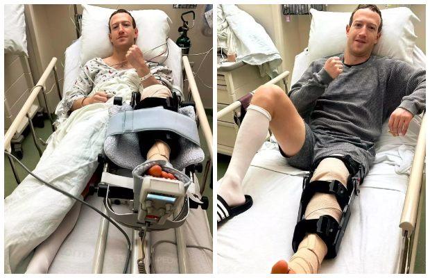 Mark Zuckerberg is recovering after surgery for his torn ACL