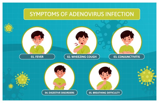 Adenovirus (ADV) goes uncontrollable in Karachi