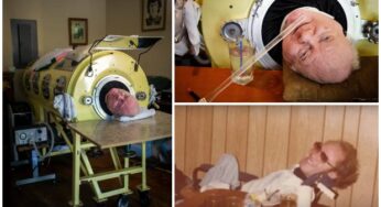 ‘Polio Paul’ Alexander, who spent 72 years inside an iron lung, is no more