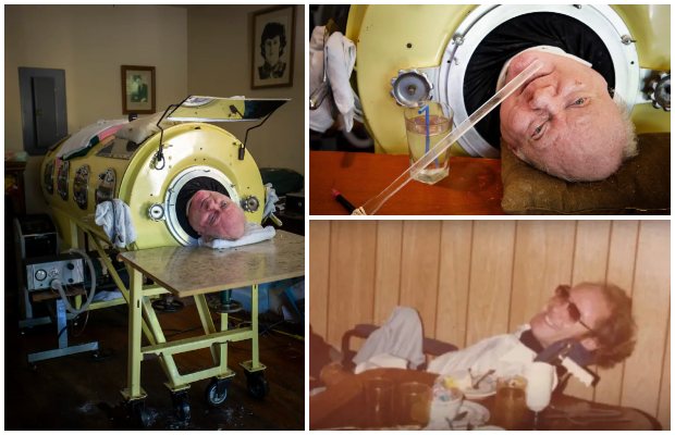 ‘Polio Paul’ Alexander, who spent 72 years inside an iron lung, is no more